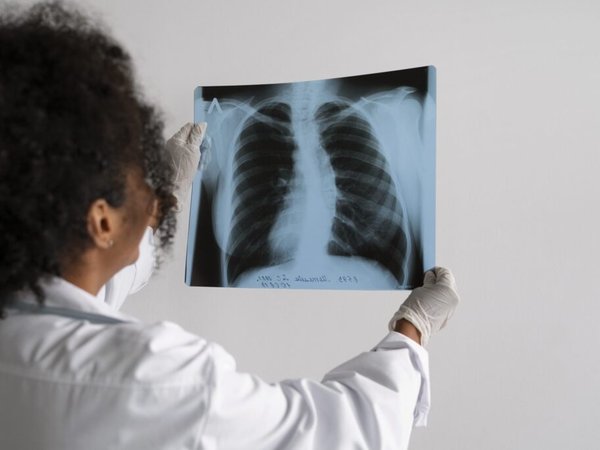 Saúde coleta 508 amostras em busca ativa por casos de tuberculose